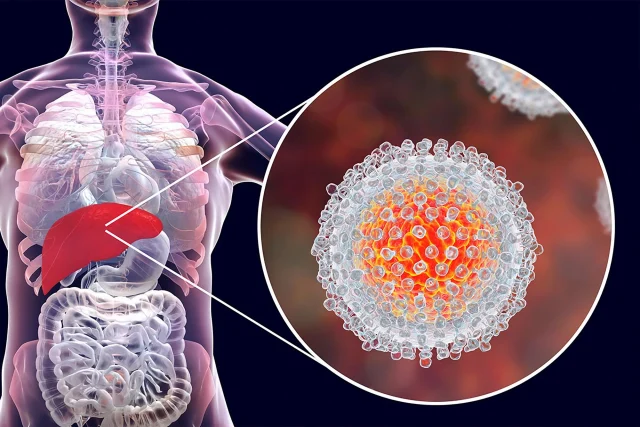 Saiba mais sobre hepatites